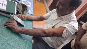 రోడ్ పనులు పర్యవేక్షిస్తున్న డాక్టర్ మల్లేశ్వరరావు పై కత్తి తో దాడి